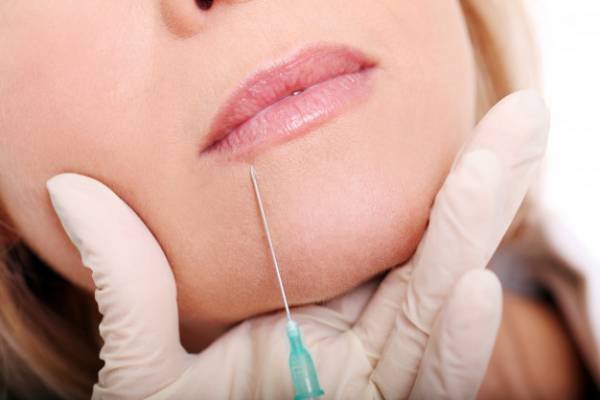 Upper Lip Lift Surgery Botox